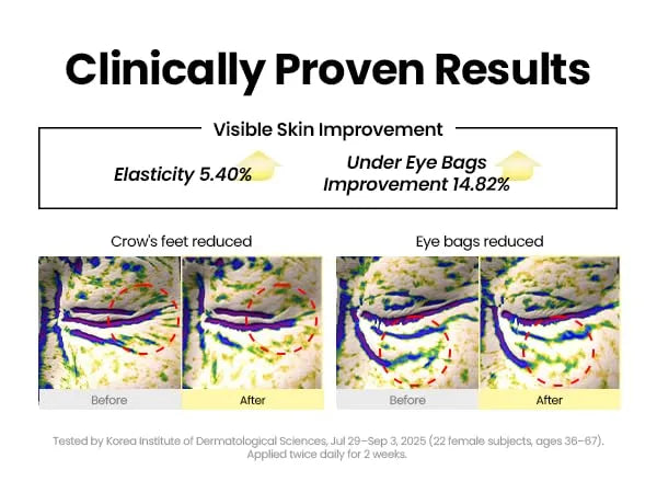 SEOUL 1988 Eye Cream : Retinal Liposome 4% + Fermented Bean