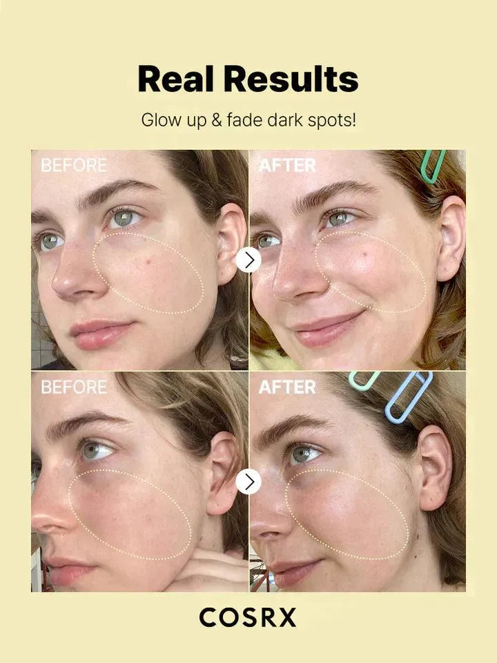 COSRX Vitamin C serum before and after results for dark spots, Korean skincare at Me Time Groningen