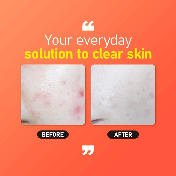 Jumiso All Day Vitamin Brightening & Balancing Facial Serum